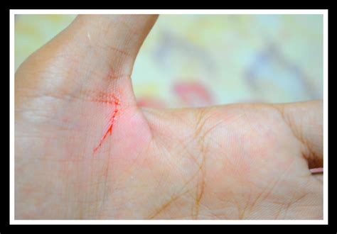 Cut My hand Again by nimitnigam on DeviantArt