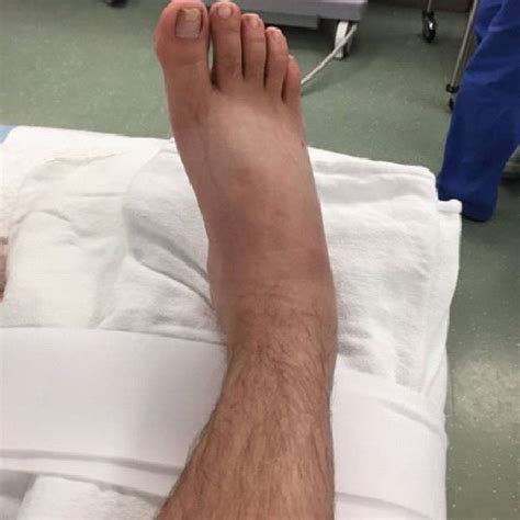 patients  ankle  scientific diagram