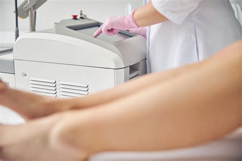 What is the Best Laser Vein Treatment in Columbia?