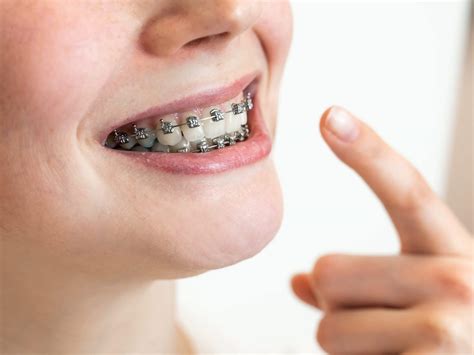 How has orthodontics changed? - The London Centre for Cosmetic Dentistry