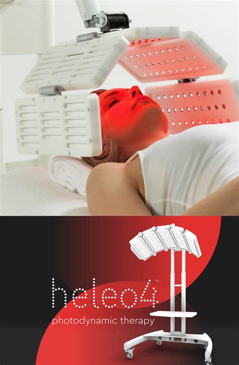 Фотодинамическая терапия лица Heleo-4. Цена процедуры Хелео 4 в VIP ...