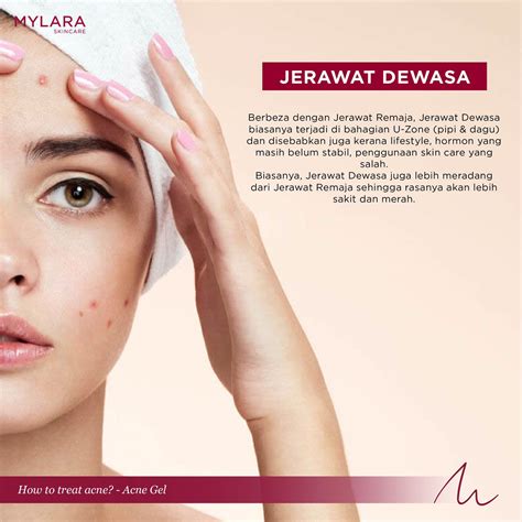 JERAWAT REMAJA VS JERAWAT DEWASA – MYLARA Skincare