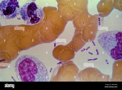 Yersinia Pestis Stock Photo - Alamy