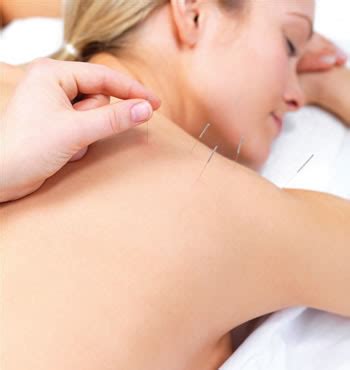 O Que Fazer Quando Sentir Agulhadas No Corpo - PROFESSOR SEM FRONTEIRAS: Acupuntura-Agulhadas no ponto certo.