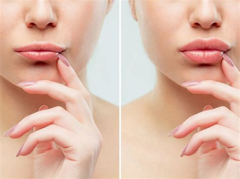 Everything You Need To Know About "Russian Lips" — Urban You - Modern