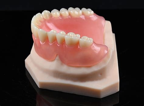 valplast fullcomplete denture valplast full upper denture golden