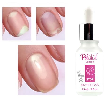 Stop onycholysis oil nail treatment 15 ml - Polish'd London