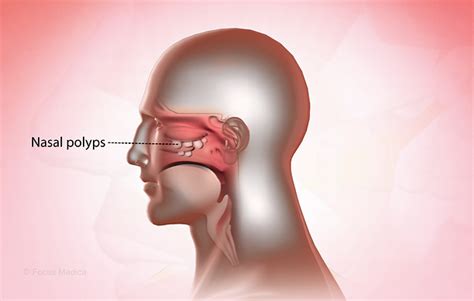 Health Condition : Symptoms, Causes, Treatment and More