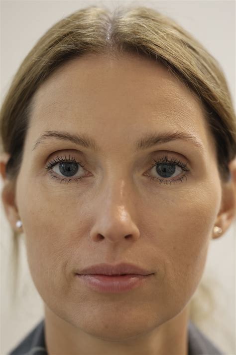 Jw Woodward: Before and After Photos That Will Amaze You! - mmcehk3