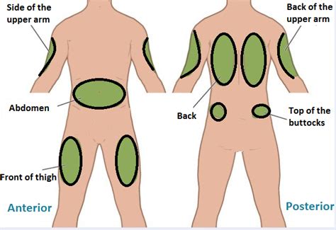 sites  subcutaneous injection  complications