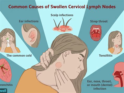 Cervical Lymph Nodes