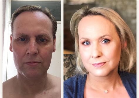 May 17 -> Oct 18 (49, Pre-op MTF, fulltime, 21 months HRT ...