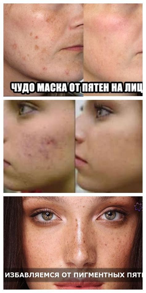 Kontat | Лицо, Маски, Чистое лицо