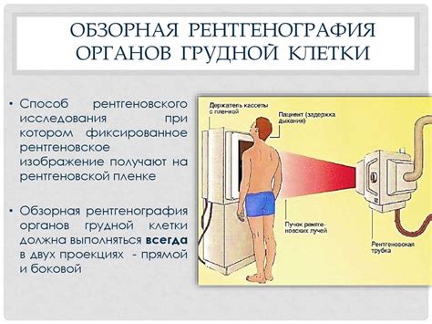 Нормальная рентгенограмма органов грудной клетки в прямой, боковой ...