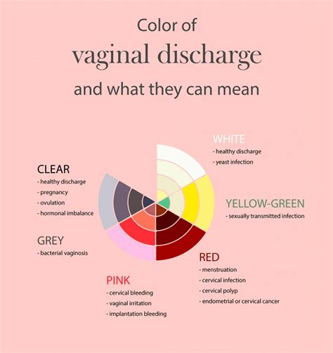 colour coded guide  vaginal discharge