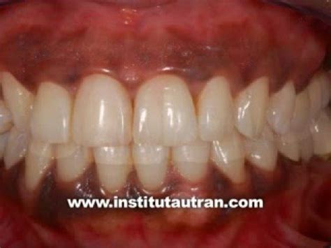 Finding Dental Clinics - PELIONCHESS