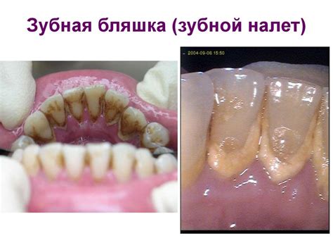 Строение зуба. Эмаль - online presentation