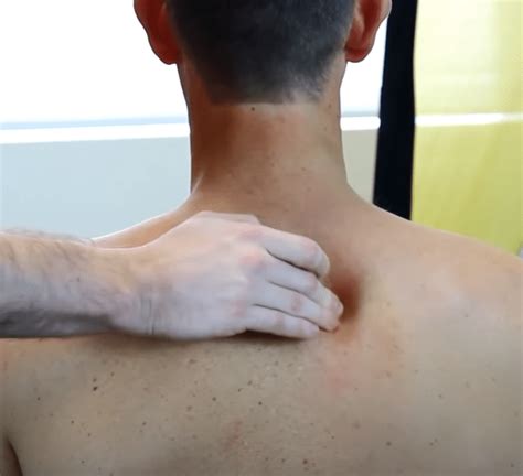 Кальцифицирующий тендинит. Симптомы, диагностика, лечение. | Формула ...
