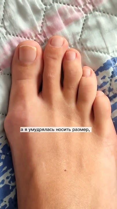 Наши кривые пальцы - результат выбора обуви! - YouTube