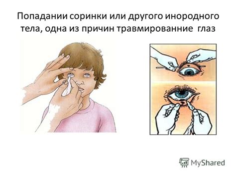 Презентация на тему: "Травмы глаз Учитель – дефектолог: Санникова Е. В ...