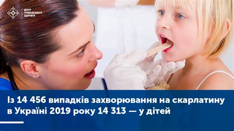 Що варто знати про скарлатину | Центр громадського здоров’я