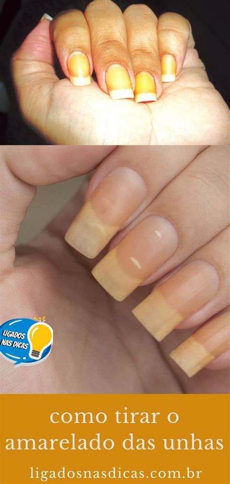 Tirar Amarelo Das Unhas - Como Tirar O Amarelado Das Unhas | Ligados Nas Dicas | Unhas, Acertou ...