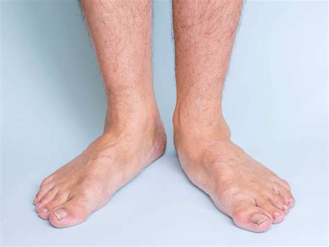Arch and Ball Pain Treatment | Family Foot Care & Surgery