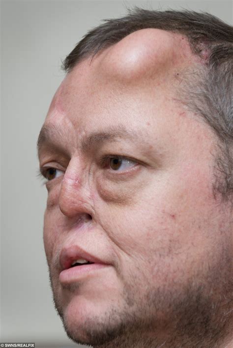 "My fiance is growing a nose on his forehead" ( for Sunday Mirr "My ...