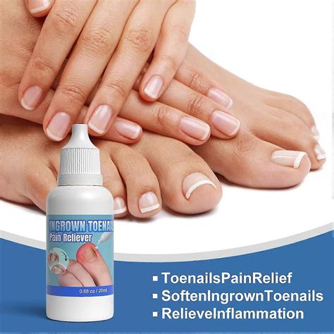 Ingrown Toenail Treatment Extra Strong, 20ml Ingrown Toenail Drop