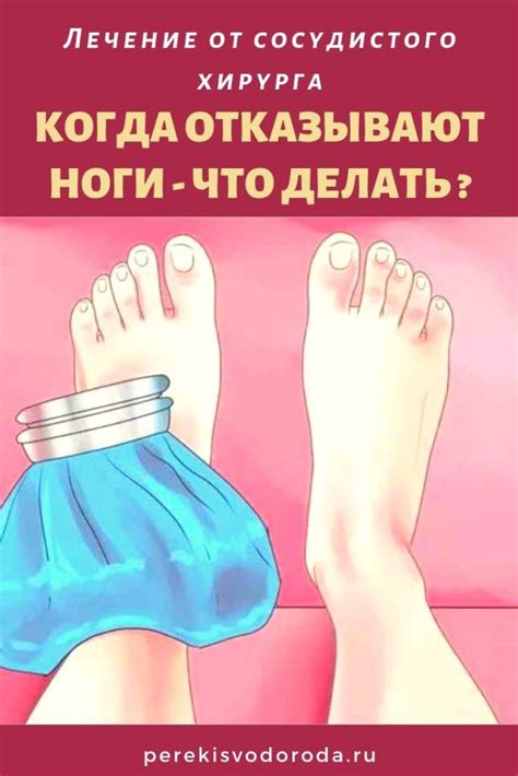 Когда отказывают ноги - что делать? Лечение от сосудистого хирурга ...