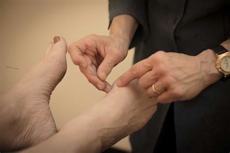 Treatable Conditions | Cosmetic Acupuncture in Louisville, KY