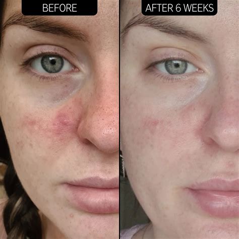Experience The B07D2CCSQ1 Difference: Before & After