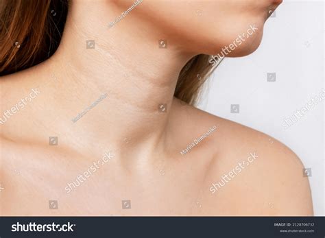 shot young woman lines  neck stock photo  shutterstock