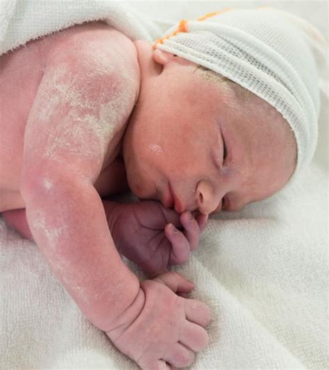 vernix caseosa    benefits  risks  baby
