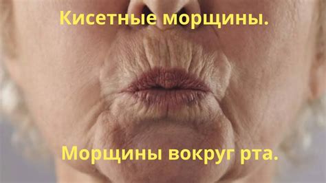 Кисетные морщины вокруг рта. Домашняя маска для губ от морщин ...