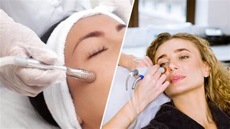 Difference Between HydraFacial and Microdermabrasion | HydraFacial vs ...