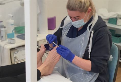 Verruca Treatments for Stubborn Warts | Pendle Chiropody Clinic