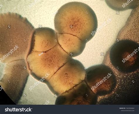 Pseudomonas Aeruginosa Colonies Under Microscope Stock Photo 1563094864 ...
