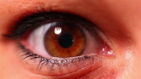 Female Eye Conjunctival Sac Instill Eye Stock Photo 1334168669 ...