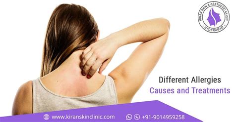 Skin allergies treatment in hyderabad | Kiran Skin Clinic