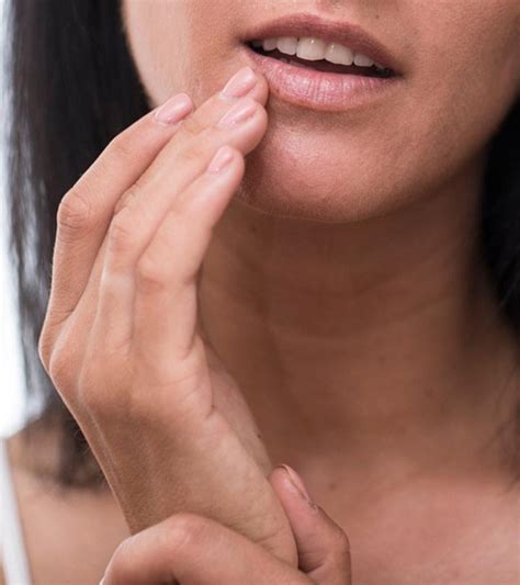 How To Get Rid Of Pimple On Lip: Remedies & Prevention
