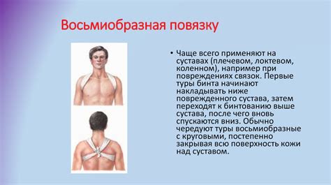 Виды повязок - online presentation