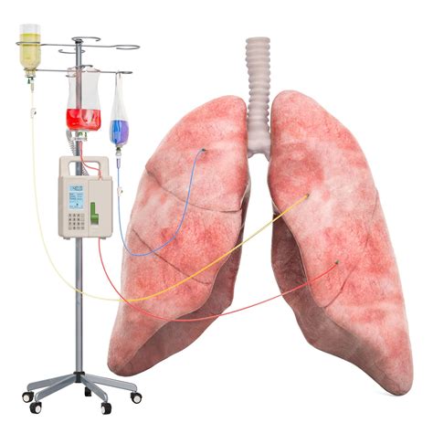Sistema de terapia intravenosa com pulmão humano tratamento do conceito de doença pulmonar