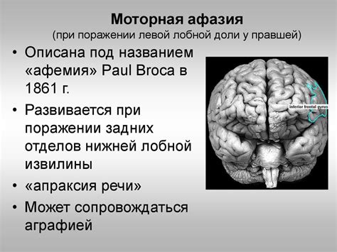 Топическая диагностика поражений коры головного мозга - презентация онлайн