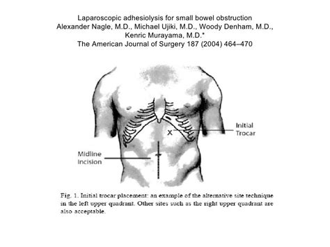 Laparoscopic Adhesiolysis