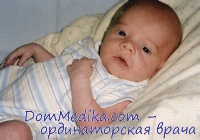Синдромы Смита-Лемли-Опитца, гидроцефалии, Цельвегера. Особенности