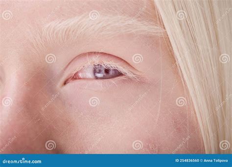 Albino Woman with Blue Eyes Stock Photo - Image of unusual ...
