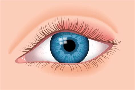 swollen eyelids   vision