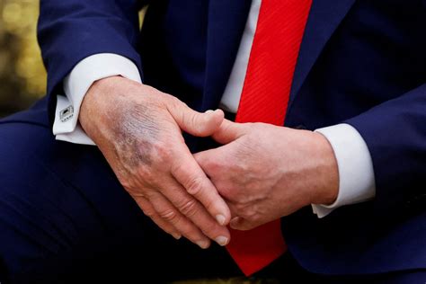 health  perfect trump    interview  speculation