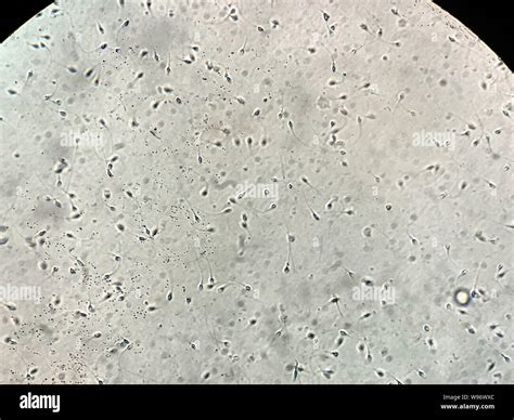 Human sperm cell hi-res stock photography and images - Alamy